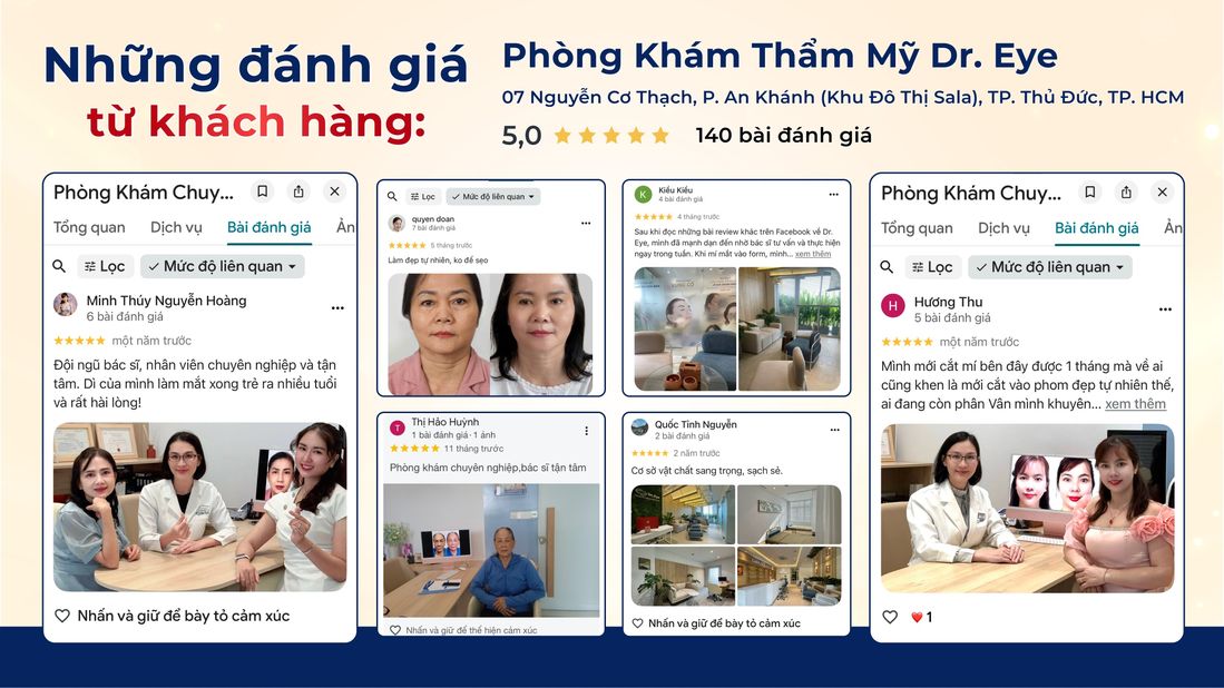 Đánh giá 5 sao từ khách hàng Dr. Eye trên Google Maps – điều trị sụp mí TP.HCM
